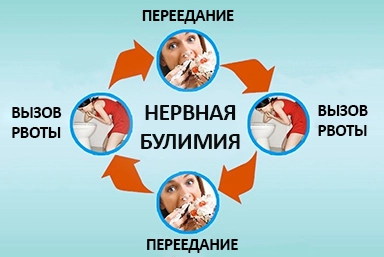 Лечение булимии в Усть-Куте